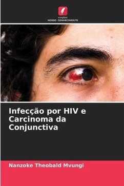 Infecção por HIV e Carcinoma da Conjunctiva - Mvungi, Nanzoke Theobald