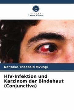 HIV-Infektion und Karzinom der Bindehaut (Conjunctiva) - Mvungi, Nanzoke Theobald
