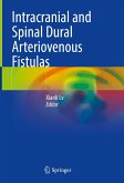 Intracranial and Spinal Dural Arteriovenous Fistulas (eBook, PDF)