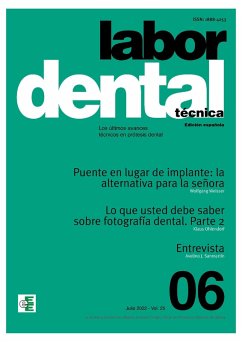 Labor Dental Técnica Nº6 Vol.25 (eBook, PDF)