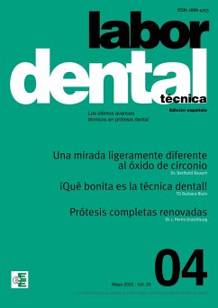 Labor Dental Técnica Nº4 Vol.25 (eBook, PDF)