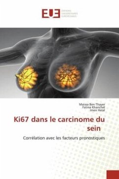 Ki67 dans le carcinome du sein - Ben Thayer, Maissa;khanchel, Fatma;Helal, Imen