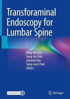 Transforaminal Endoscopy for Lumbar Spine