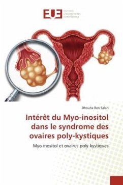 Intérêt du Myo-inositol dans le syndrome des ovaires poly-kystiques - Ben Salah, Dhouha