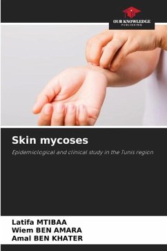 Skin mycoses - Mtibaa, Latifa;BEN AMARA, Wiem;BEN KHATER, Amal