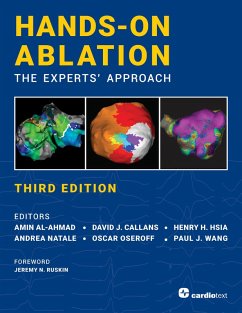Hands-On Ablation, The Experts' Approach, Third Edition (eBook, ePUB)