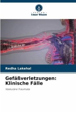 Gefäßverletzungen: Klinische Fälle - Lakehal, Redha