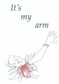 It's my arm