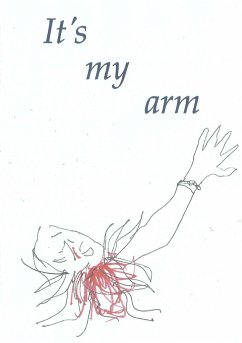 It's my arm - Weston, Tony