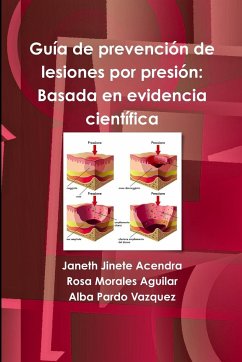 Guía de prevención de lesiones por presión - Jinete Acendra, Janeth; Morales Aguilar, Rosa; Pardo Vazquez, Alba