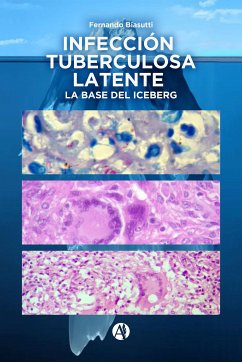 Infección Tuberculosa Latente, la base del iceberg (eBook, ePUB) - Biasutti, Fernando