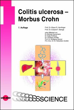 Colitis ulcerosa - Morbus Crohn - Herrlinger, Klaus R.;Stange, Eduard F.