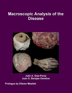 Macroscopic Analysis of the Disease - Diaz-Perez, Julio; Barajas-Gamboa, Juan