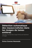 Détection automatique des noyaux/cellules dans les images de lames entières