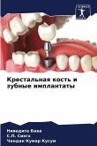Krestal'naq kost' i zubnye implantaty