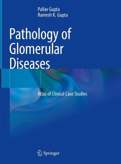 Pathology of Glomerular Diseases (eBook, PDF) - Gupta, Pallav; Gupta, Ramesh K.