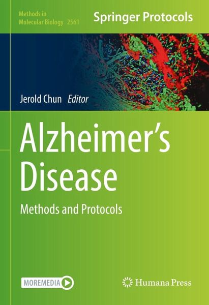 Alzheimer's Disease (eBook, PDF)