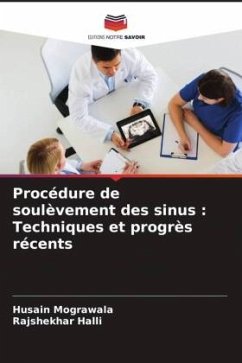 Procédure de soulèvement des sinus : Techniques et progrès récents - Mograwala, Husain;Halli, Rajshekhar