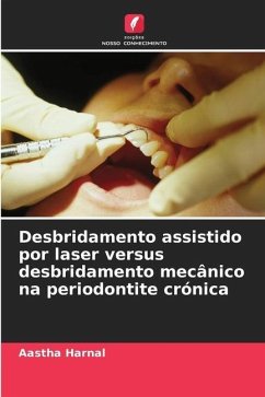Desbridamento assistido por laser versus desbridamento mecânico na periodontite crónica - Harnal, Aastha