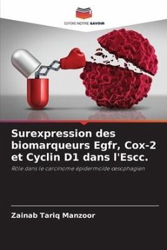 Surexpression des biomarqueurs Egfr, Cox-2 et Cyclin D1 dans l'Escc. - Tariq Manzoor, Zainab
