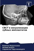 CBCT w wizualizacii zubnyh implantatow