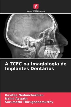 A TCFC na Imagiologia de Implantes Dentários - Nedunchezhian, Kavitaa;Aswath, Nalini;Thirugnanamurthy, Sarumathi