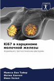Ki67 w karcinome molochnoj zhelezy