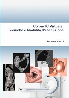 Colon-TC Virtuale - Franchi, Francesco