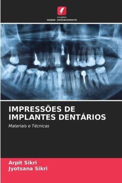 IMPRESSÕES DE IMPLANTES DENTÁRIOS - Sikri, Arpit;Sikri, Jyotsana