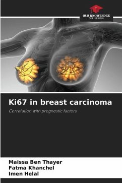 Ki67 in breast carcinoma - Ben Thayer, Maissa;khanchel, Fatma;Helal, Imen