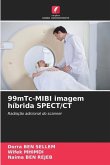 99mTc-MIBI imagem híbrida SPECT/CT