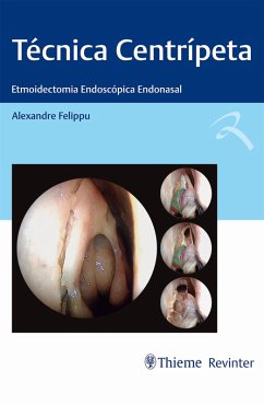 Cover Técnica Centrípeta (eBook, ePUB)