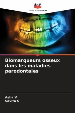 Biomarqueurs osseux dans les maladies parodontales - V, Asha;S, Savita