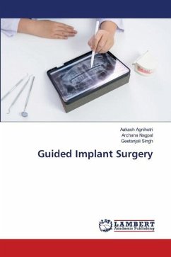 Guided Implant Surgery - Agnihotri, Aakash;Nagpal, Archana;Singh, Geetanjali