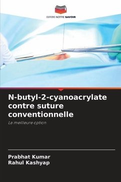 N-butyl-2-cyanoacrylate contre suture conventionnelle - Kumar, Prabhat;Kashyap, Rahul