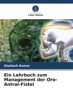 Ein Lehrbuch zum Management der Oro-Antral-Fistel - Kumar, Shailesh;Kiran, Kamini;Singh, Rameshwar