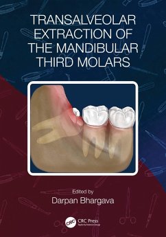 Transalveolar Extraction of the Mandibular Third Molars (eBook, ePUB)