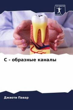 Cover S - obraznye kanaly