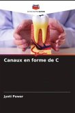 Canaux en forme de C