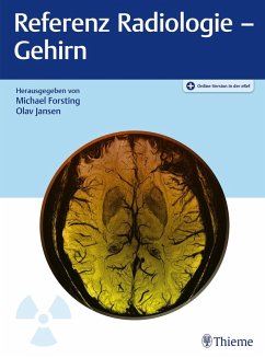 Referenz Radiologie - Gehirn (eBook, ePUB)