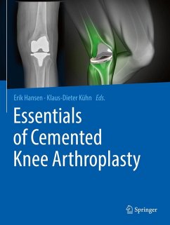 Essentials of Cemented Knee Arthroplasty Essentials of Cemented Knee Arthroplasty