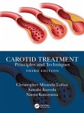 Carotid Treatment: Principles and Techniques (eBook, ePUB)