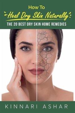 How to Heal Dry Skin Naturally - Ashar, Kinnari