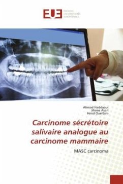 Carcinome sécrétoire salivaire analogue au carcinome mammaire - Haddaoui, Ahmad;Ayari, Jihene;Ouertani, Hend