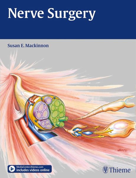 Nerve Surgery (eBook, ePUB)