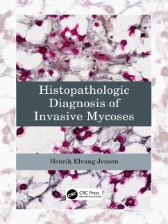 Histopathologic Diagnosis of Invasive Mycoses (eBook, PDF) - Jensen, Henrik Elvang