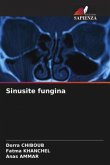Sinusite fungina