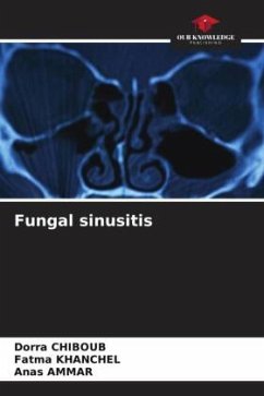 Fungal sinusitis - CHIBOUB, Dorra;khanchel, Fatma;AMMAR, Anas