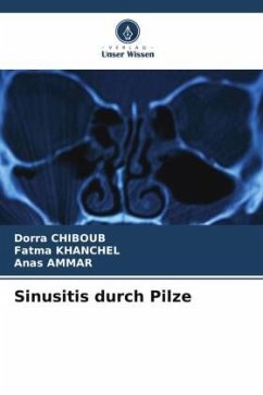 Sinusitis durch Pilze - CHIBOUB, Dorra;khanchel, Fatma;AMMAR, Anas