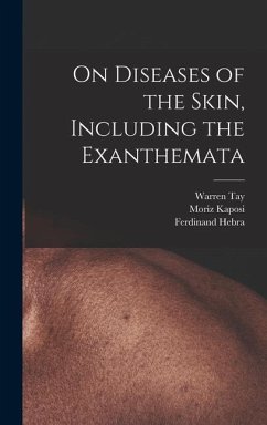 On Diseases of the Skin, Including the Exanthemata - Kaposi, Moriz; Hebra, Ferdinand; Tay, Warren